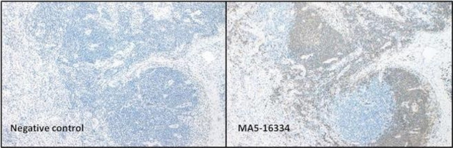 CD20 Antibody in Immunohistochemistry (IHC)