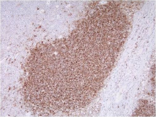 CD20 Antibody in Immunohistochemistry (Paraffin) (IHC (P))