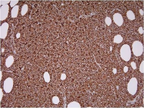 CD20 Antibody in Immunohistochemistry (Paraffin) (IHC (P))