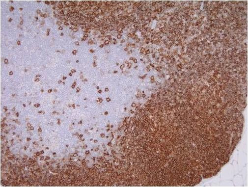 CD20 Antibody in Immunohistochemistry (Paraffin) (IHC (P))