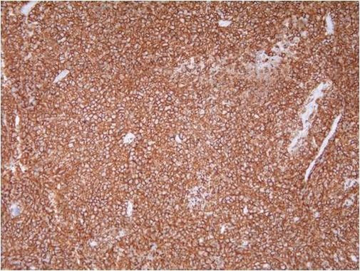 CD20 Antibody in Immunohistochemistry (Paraffin) (IHC (P))