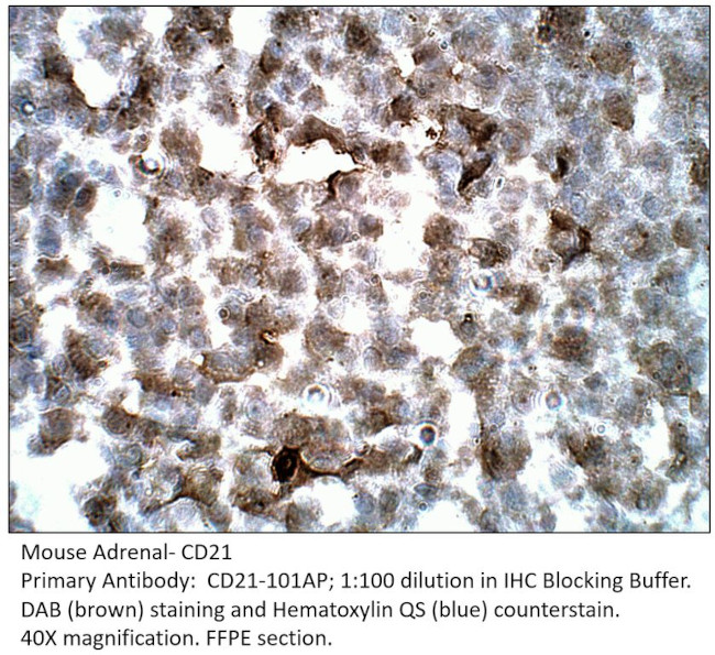 CD21 Antibody in Immunohistochemistry (IHC)