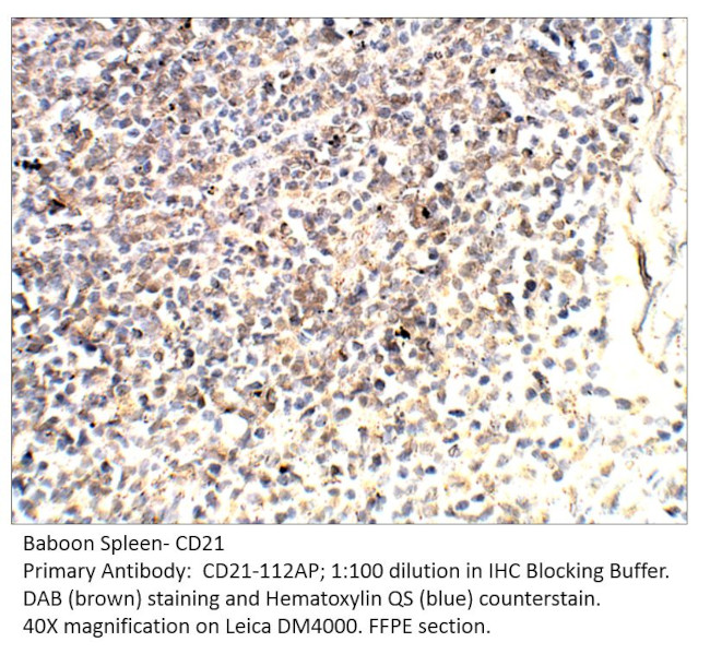 CD21 Antibody in Immunohistochemistry (IHC)