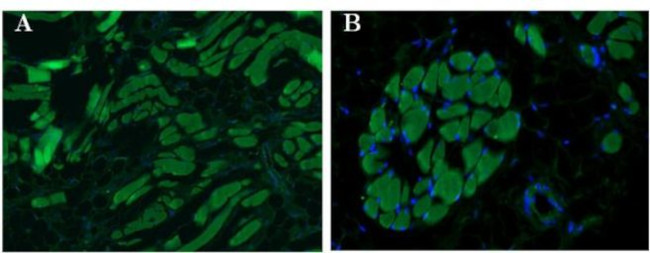 CD21 Antibody in Immunohistochemistry (Paraffin) (IHC (P))