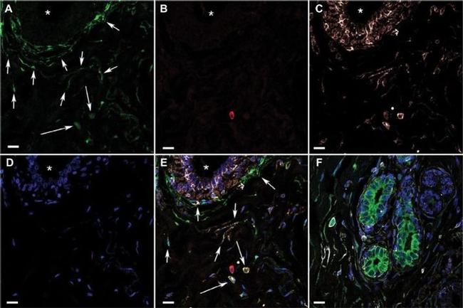 CD44 Antibody in Immunohistochemistry (IHC)