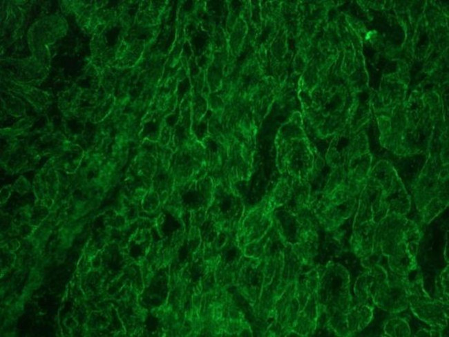 ITGB1 Antibody in Immunohistochemistry (Frozen) (IHC (F))