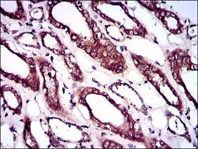 BMPR1A Antibody in Immunohistochemistry (Paraffin) (IHC (P))