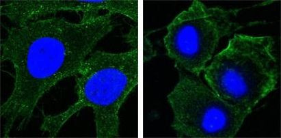 VEGF Receptor 2 Antibody in Immunocytochemistry (ICC/IF)