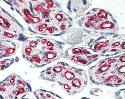 CD31 Antibody in Immunohistochemistry (Paraffin) (IHC (P))