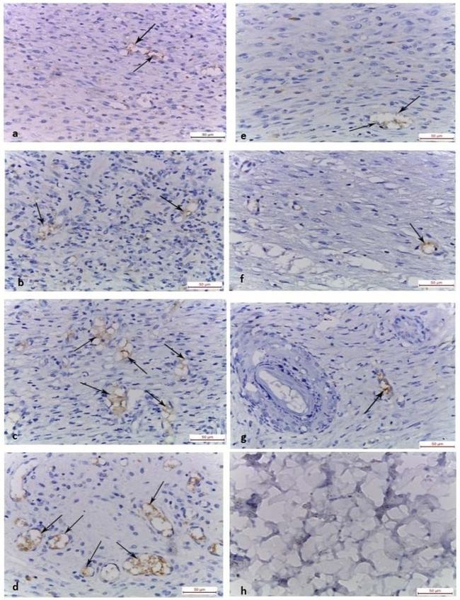 CD31 Antibody in Immunohistochemistry (IHC)