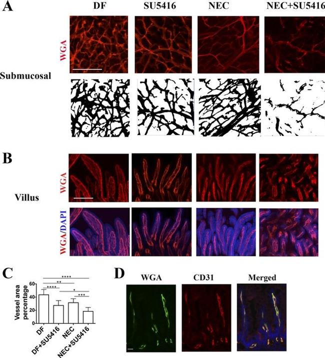 CD31 (PECAM-1) Antibody in Immunohistochemistry (IHC)