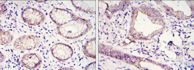 E-cadherin Antibody in Immunohistochemistry (Paraffin) (IHC (P))