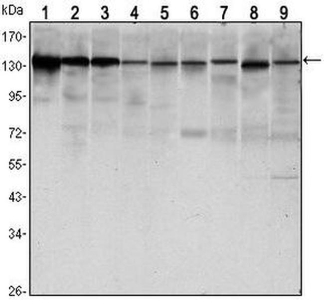 E-cadherin Antibody in Western Blot (WB)