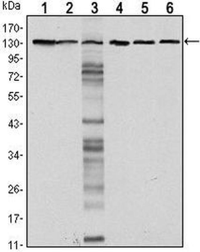 E-cadherin Antibody in Western Blot (WB)