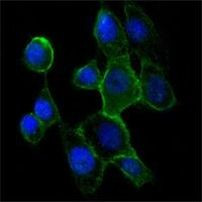 N-cadherin Antibody in Immunocytochemistry (ICC/IF)