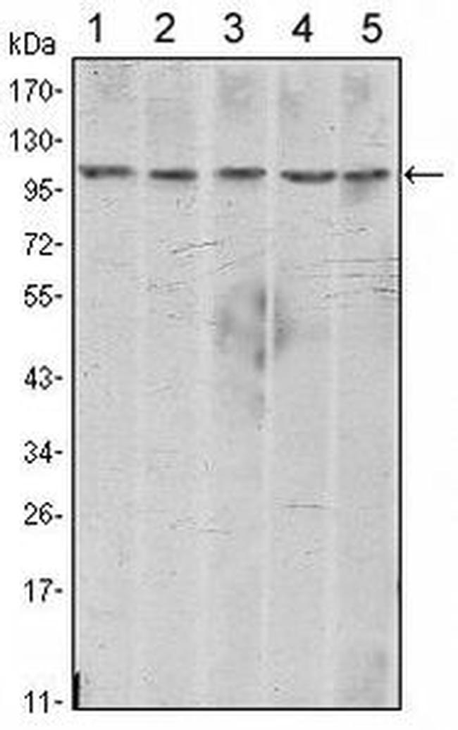 N-cadherin Antibody in Western Blot (WB)