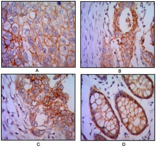 EpCAM Antibody in Immunohistochemistry (Paraffin) (IHC (P))