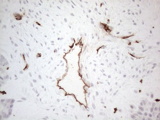 CD34 Antibody in Immunohistochemistry (Paraffin) (IHC (P))