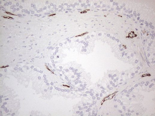 CD34 Antibody in Immunohistochemistry (Paraffin) (IHC (P))