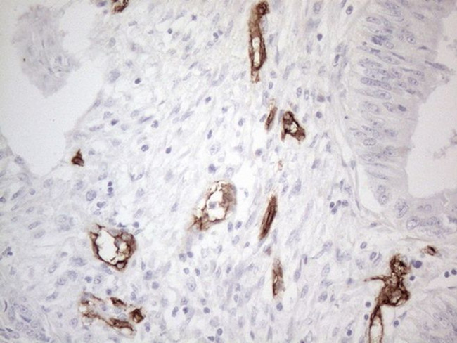 CD34 Antibody in Immunohistochemistry (Paraffin) (IHC (P))