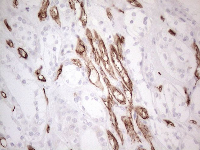 CD34 Antibody in Immunohistochemistry (Paraffin) (IHC (P))