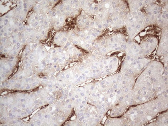 CD34 Antibody in Immunohistochemistry (Paraffin) (IHC (P))