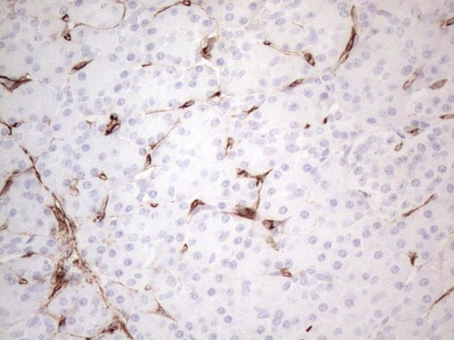 CD34 Antibody in Immunohistochemistry (Paraffin) (IHC (P))