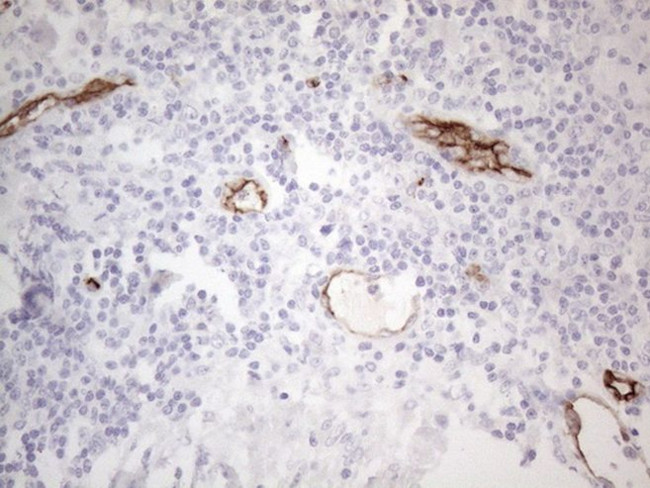 CD34 Antibody in Immunohistochemistry (Paraffin) (IHC (P))