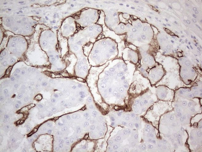 CD34 Antibody in Immunohistochemistry (Paraffin) (IHC (P))