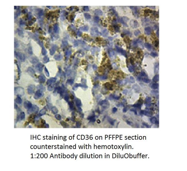 CD36 Antibody in Immunohistochemistry (Paraffin) (IHC (P))