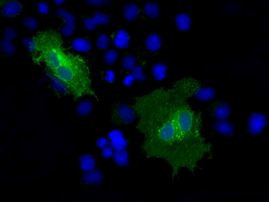 CD36 Antibody in Immunocytochemistry (ICC/IF)