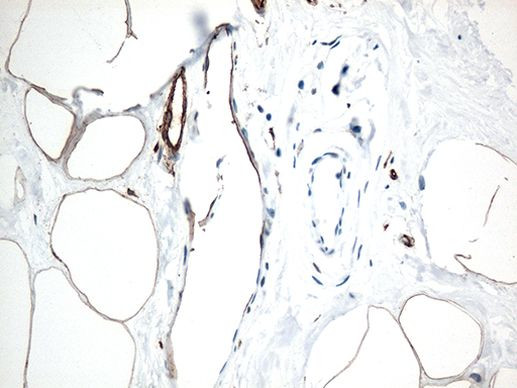 CD36 Antibody in Immunohistochemistry (Paraffin) (IHC (P))