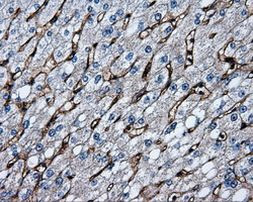 CD36 Antibody in Immunohistochemistry (Paraffin) (IHC (P))