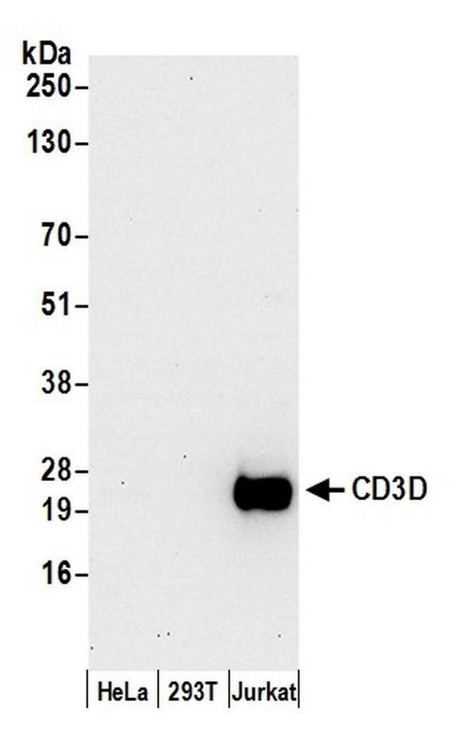 CD3D Antibody in Western Blot (WB)