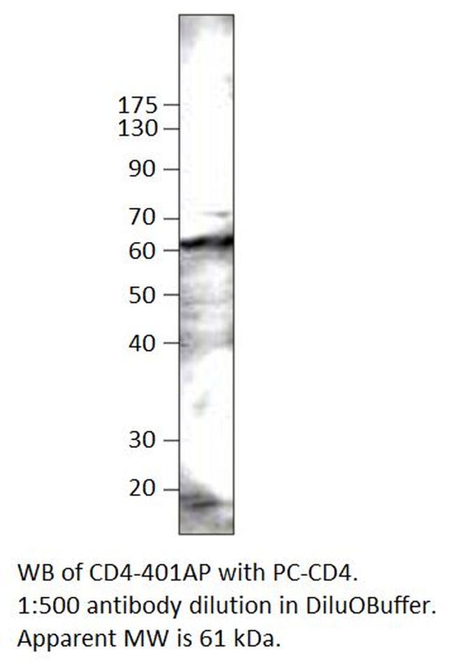 CD4 Antibody in Western Blot (WB)