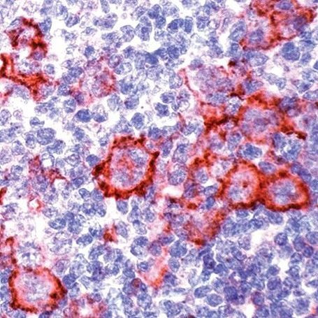 CD40 Antibody in Immunohistochemistry (Paraffin) (IHC (P))