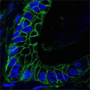 CD44 Antibody in Immunohistochemistry (Paraffin) (IHC (P))