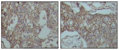 CD44 Antibody in Immunohistochemistry (Paraffin) (IHC (P))