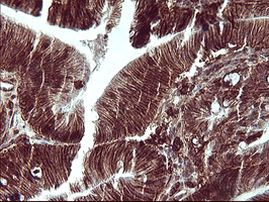 CD44 Antibody in Immunohistochemistry (Paraffin) (IHC (P))