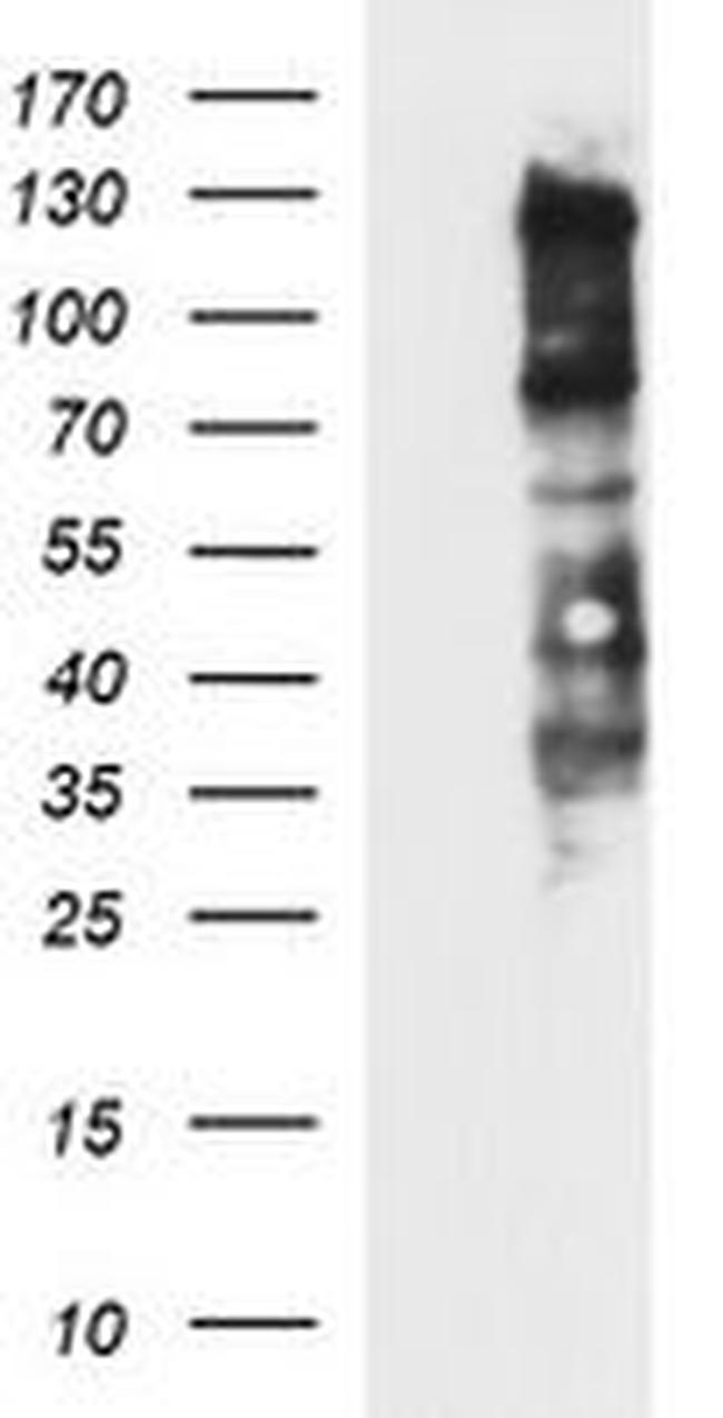 CD44 Antibody in Western Blot (WB)