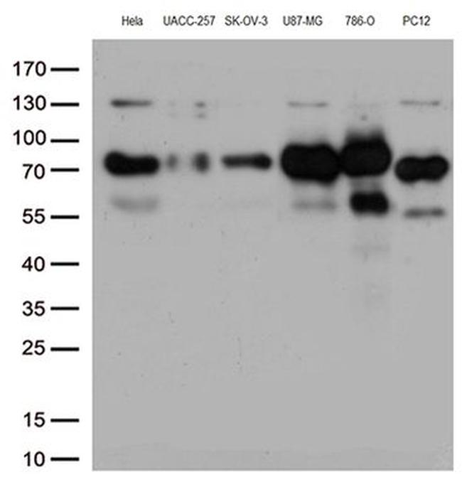 CD44 Antibody in Western Blot (WB)