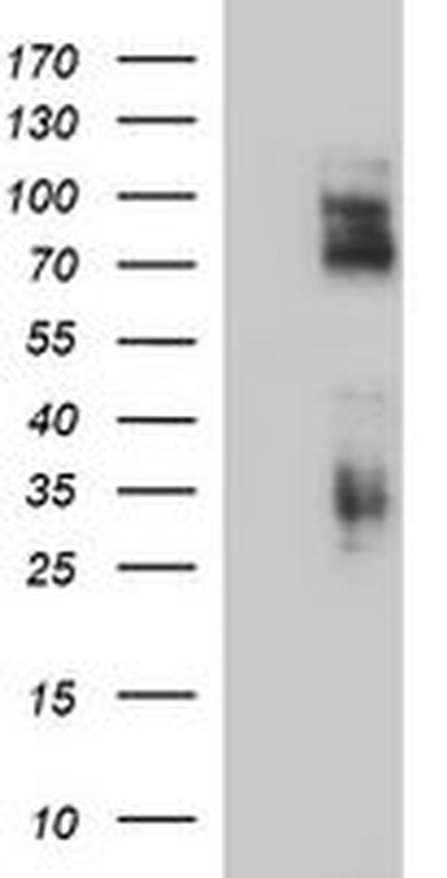 CD44 Antibody in Western Blot (WB)