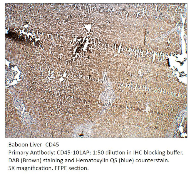 CD45 Antibody in Immunohistochemistry (IHC)