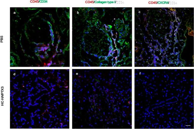 CD45 Antibody in Immunohistochemistry (IHC)