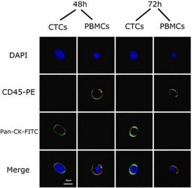 CD45 Antibody in Immunocytochemistry (ICC/IF)