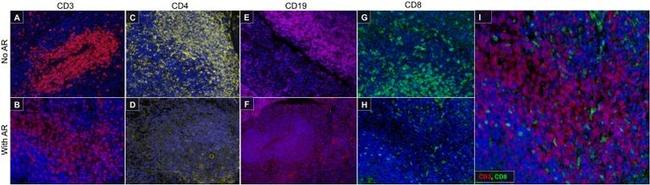 CD4 Antibody in Immunohistochemistry (IHC)