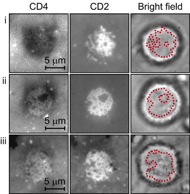 CD4 Antibody in Immunocytochemistry (ICC/IF)