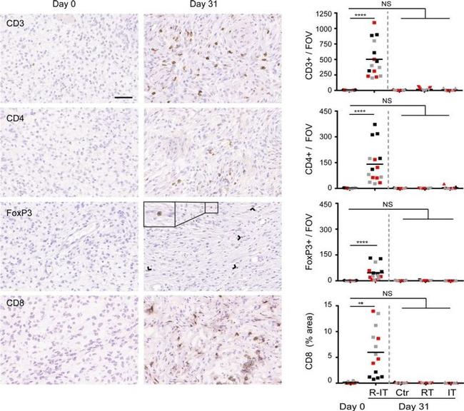 CD4 Antibody