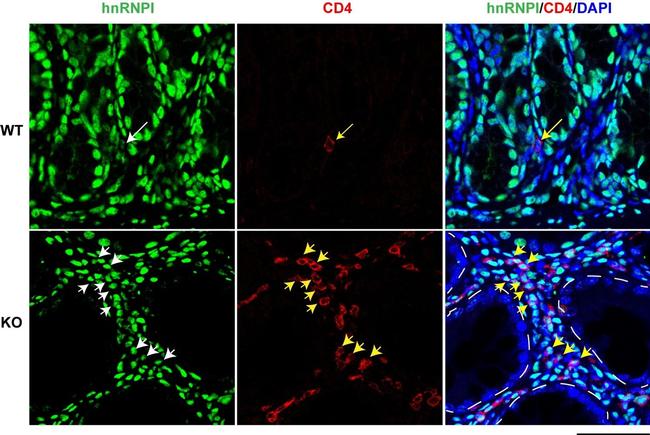 CD4 Antibody in Immunohistochemistry (IHC)