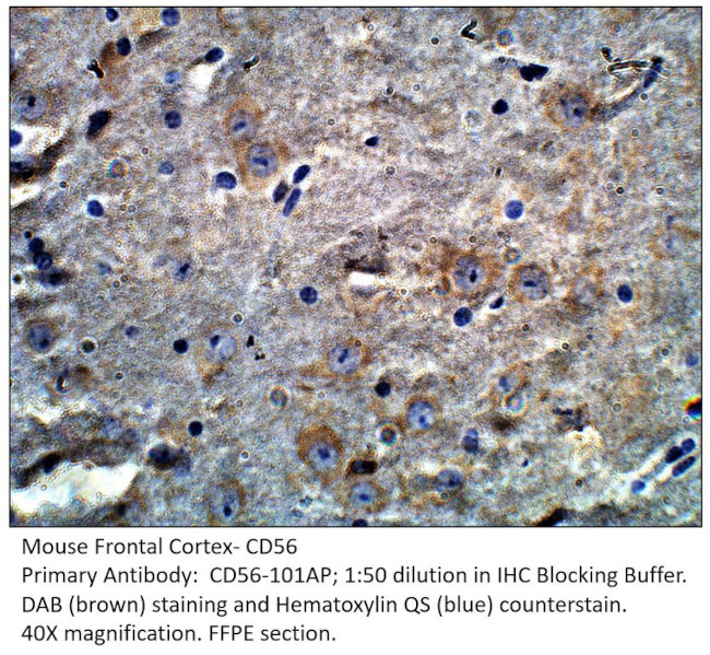 CD56/NCAM Antibody in Immunohistochemistry (IHC)